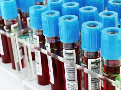 新型血液检测技术如何改善人类健康?
